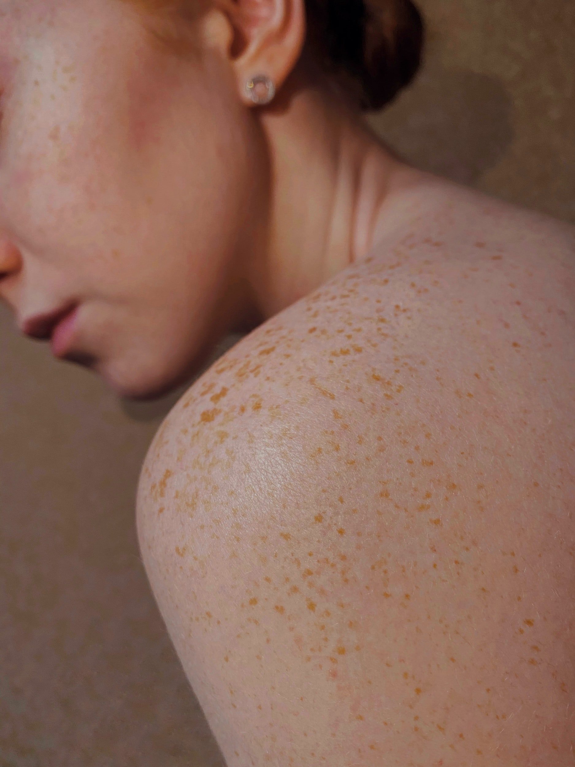 close up of woman's freckled shoulder